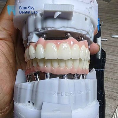 Beli Layered Zirconia Implant Customization Kasus Implantasi Lengkungan Penuh online manufacture