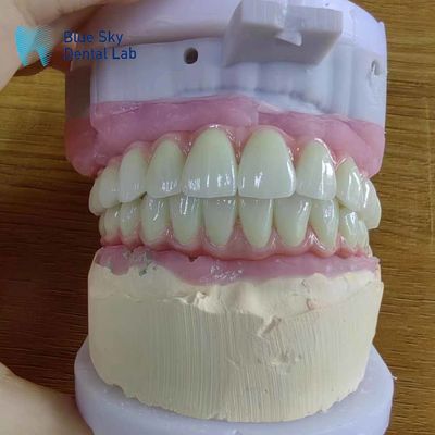 Beli Kompatibilitas Universal Jembatan Malo Logam Dengan Kerangka Titanium Murni online manufacture