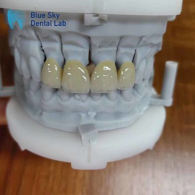 Beli Zirconia tahan lama berlapis dengan Porselen Zirconia Multilayer Crown online manufacture