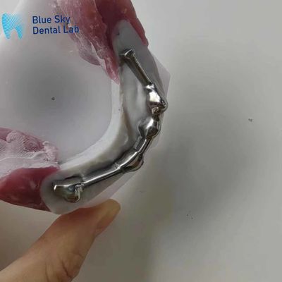 Beli Bar Titanium Gigi yang dapat disesuaikan dengan gigi abutment untuk gigi palsu online manufacture