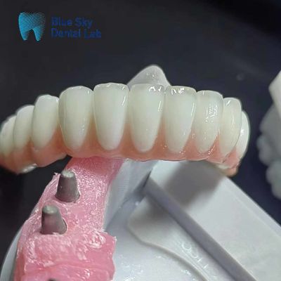 Beli Kasus Implan Zirconia Biasa Kasus Implan Gigi Pribadi online manufacture