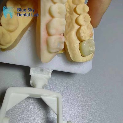Beli Korona Zirconia yang tahan korosi online manufacture