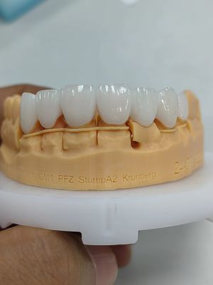 Beli 5mm-6mm Layered Zirconia Crown Kekuatan Zirconia Multilayer Crown online manufacture