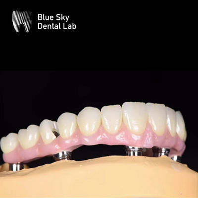 Beli Blue Sky Nature Kasus Implantasi Gigi Sistem Implantasi Berbagai Pilihan online manufacture