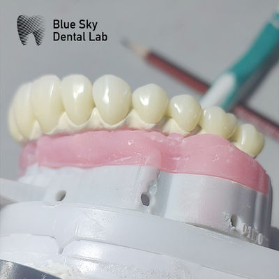 Beli Titanium murni Malo Implant Bridge Universal Metal Frame Malo Bridge online manufacture