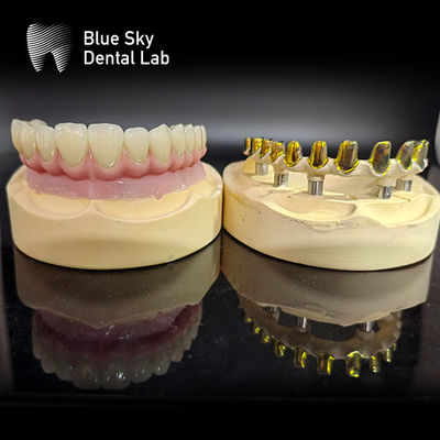 Beli Sekrup dipertahankan MUA pilar Implan Kasus Zirconia mahkota Multilayer porselen merah muda dengan perbaikan mudah online manufacture