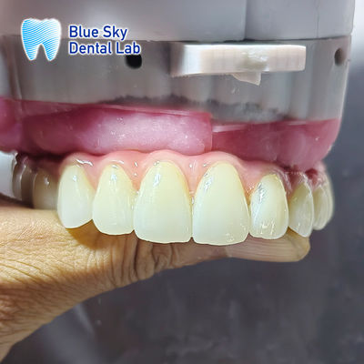 Beli Kasus Implantasi untuk Sistem Implantasi Multiple online manufacture