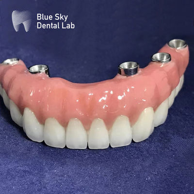Beli Universal Autoclavable Rectangular Implant Cases permukaan halus Warna Perak online manufacture
