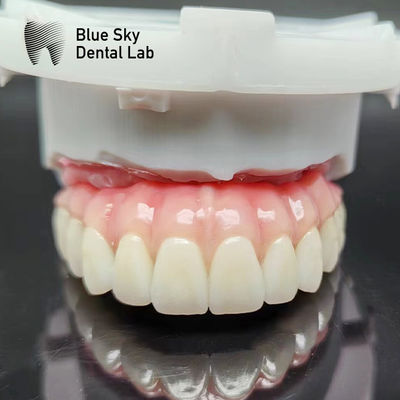 Beli Kasus Implan Gigi Alam Lurus Kasus Implantasi Lempar untuk Sistem Implantasi online manufacture
