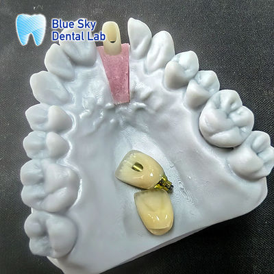 Beli Precision Milled Zirconia Abutment dengan Crown Implant Single online manufacture