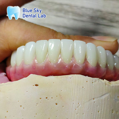 Beli Universal Kompatibilitas Kasus Implan Customized Kasus Implan Lompatan online manufacture