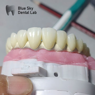 Beli Kasus Implan Gigi Universal Kompatibel Dengan Beberapa Sistem Implantasi online manufacture
