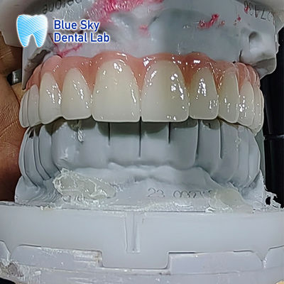 Beli Kasus implan gigi buatan Kasus implan sterilisasi ganda online manufacture
