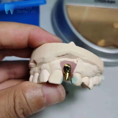 Beli Kasus Implantasi Biasa Kasus Implantasi Dental Offset Arch online manufacture