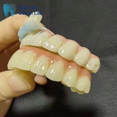Beli Kasus Implantasi Kasus Implantasi Buatan untuk Kompatibilitas Sistem Tanpa Sambutan online manufacture