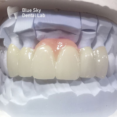 Beli Putaran Zirconia Mahkota Pink Porselen Zirconia Mahkota Gigi Untuk Restorasi Estetika online manufacture