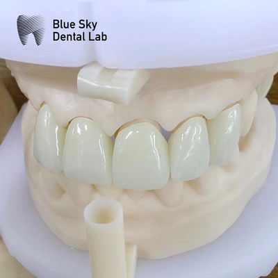Beli Natural Esthetics Multi-layered Zirconia Crown Kekuatan Tinggi Ketahanan Kimia online manufacture
