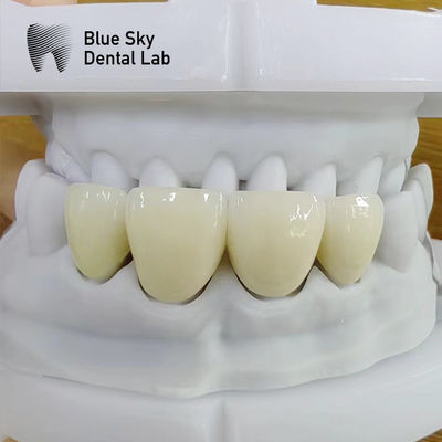 Beli Bentuk alami berlapis Zirconia Kekuatan tinggi Zircon Multilayer persegi panjang online manufacture