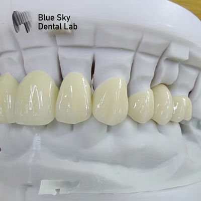 Beli Translucent Layered Zirconia Crown Restoration Dental Multilayer Zirconia Crown online manufacture