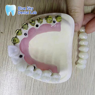 Beli Universal Full Arch Dental Implant Cases Untuk Multiple Regular Implant System online manufacture