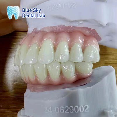 Beli Kasus Implantasi Lengkungan Penuh yang disesuaikan Kasus operasi implan universal online manufacture