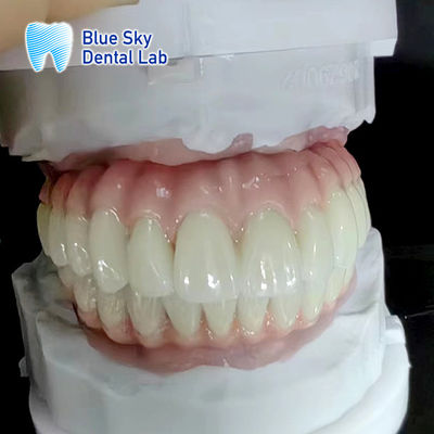 Beli Kasus Implan Gigi Biasa Sifat Dan Ketahanan Untuk Peralatan Medis online manufacture
