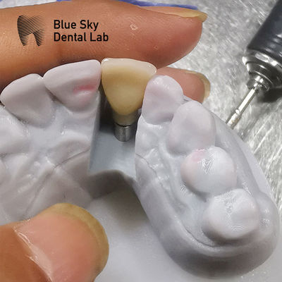 Beli Studi Biokompatibilitas Skenario Implantasi Sterilisasi Uap online manufacture