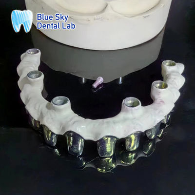 Beli Titanium murni Malo Jembatan Disesuaikan Perak Metal Frame Gigi online manufacture
