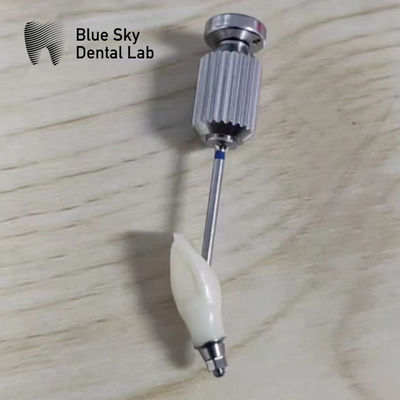 Beli Abutment Zirconia Putih untuk restorasi gigi tunggal atau ganda online manufacture