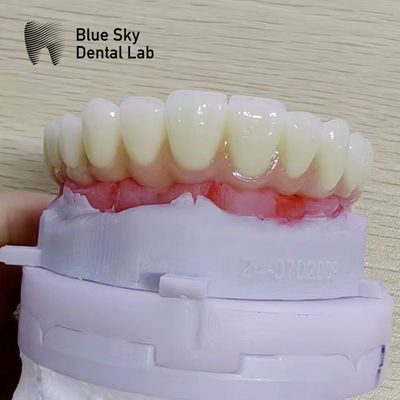 Beli Kasus Prosedur Implantasi Alam dengan Kompatibilitas Universal dan Kinerja Optimal online manufacture