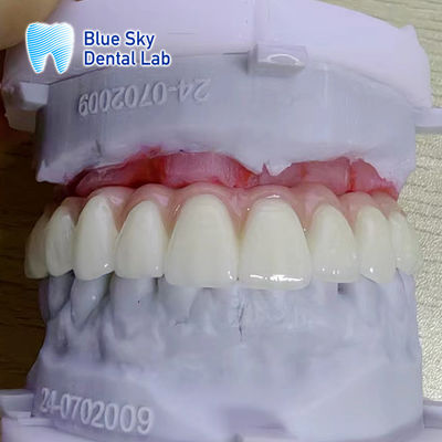 Beli Sesuaikan Warna permukaan halus Kasus Instrumen Implantasi online manufacture