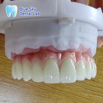 Beli Metal Frame Titanium Malo Jembatan Disesuaikan Malo Implant Jembatan online manufacture