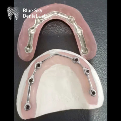 Beli Bar Titanium Gigi Dengan Gigi Akrilik Penuh Titanium Bar Untuk Implan Gigi online manufacture