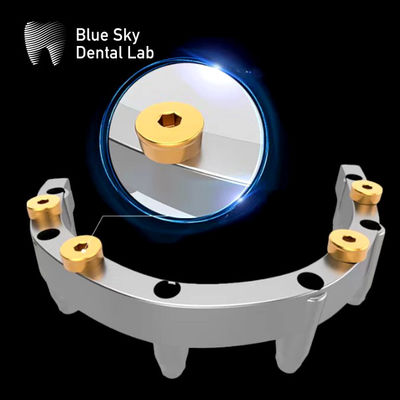 Beli Perekat Lokator yang Bisa Dihapus Implan Overdenture Titanium Upper Locator Denture online manufacture