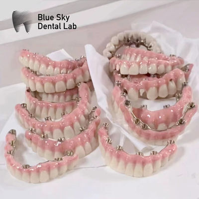 Beli Kasus Implan Blue Sky Dengan Jembatan Frame Malo Titanium Murni online manufacture