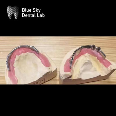 Beli Blue Sky Dental Implant Perak Titanium Bar Untuk Implantasi Gigi online manufacture
