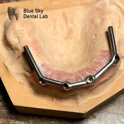 Beli Full Upper Dental Titanium Bar Full Mouth Restoration Blue Sky Implant online manufacture