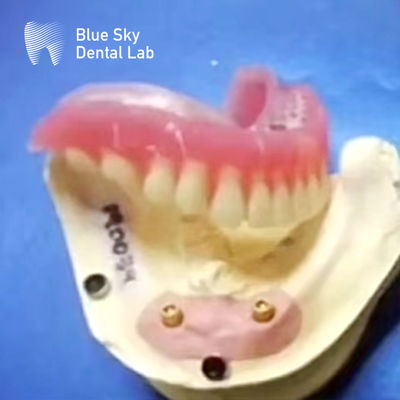 Beli Titanium Dental Locator dengan gigi gigi yang bisa dilepas dan lampiran topi bola online manufacture