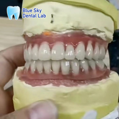 Beli Full Upper dan Lower Titanium Bar Blue Sky Implantasi Gigi online manufacture