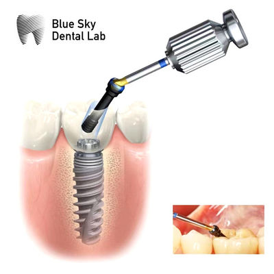 Beli Abutment ASC Hex Internal Abutment Saluran Sekrup Bersudut yang Bisa Disesuaikan online manufacture