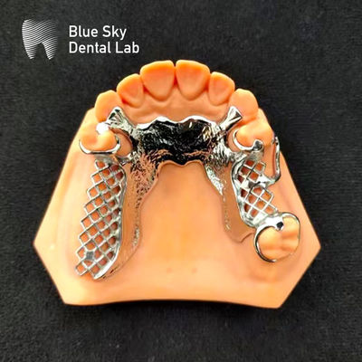 Beli Skelet Chrome Metal Parsial Dental Printed CoCr Denture Design online manufacture