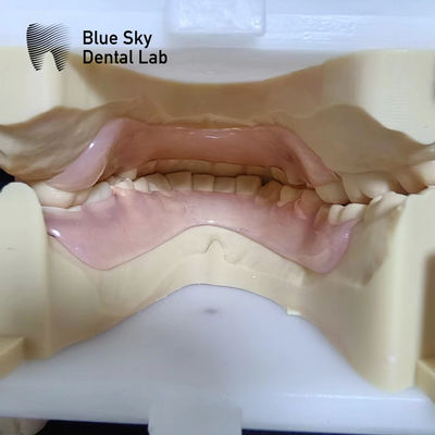 Beli Resin Valplast Fleksibel Bagian Gigi Sebelum Dan Setelah Valplast Bagian Gigi online manufacture