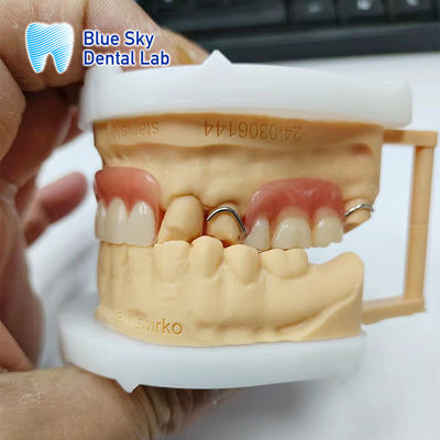 Beli Restorasi Senyum Dental Akrilik Parsial dengan Klem online manufacture
