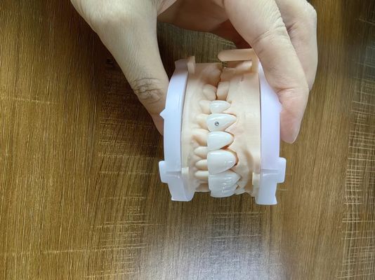 Beli Highly Translucent Zirconia Mahkota Jembatan veneers Dengan Perhiasan Disesuaikan Dan Emas Beautiful Dental Restoration Case online manufacture
