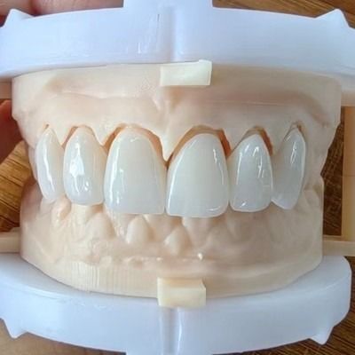 Beli Natural Esthetics Layered Zirconia Crown Bridge Untuk Senyum Cantik Dan Restorasi Yang Baik Sertifikasi FDA Dan CE online manufacture