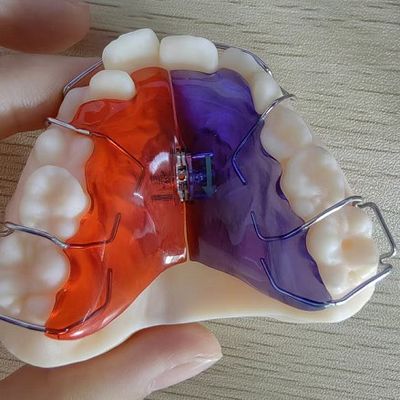 Beli Skenario Implan Plastik Permukaan Halus untuk Solusi yang Disesuaikan online manufacture