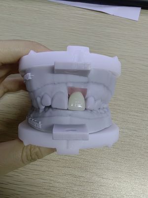 Beli Kasus Implantasi Ketahanan Tinggi Menampung 5 Implantasi untuk Fleksibilitas Prothesis yang Dapat Dihapus online manufacture