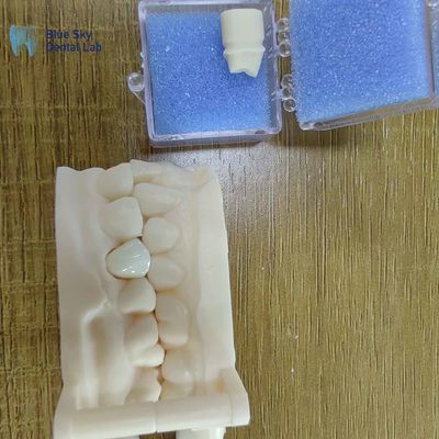 Estetika Zirconia Restorasi Gigi Zirconia Mahkota Porselen