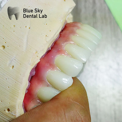Nature Surface Universal Compatible Multiple Choices Kasus operasi implan untuk Sterilisasi Uap