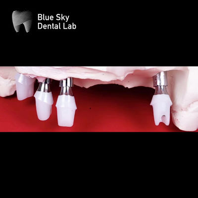 Blue Sky Implantasi Gigi Zirconia Abutment yang Digiling dengan Tepat